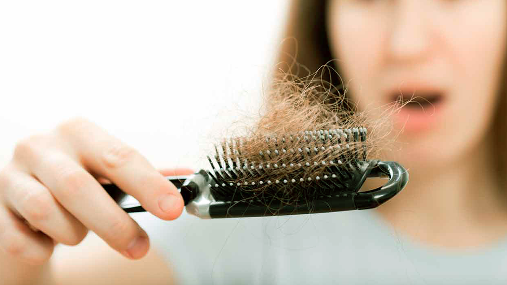 Alopecia feminina: como tratar a queda de cabelo na mulher