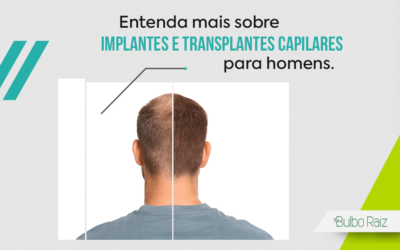 Implante e Transplante Capilar Masculino: Saiba Mais