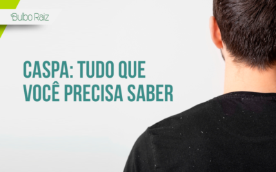 Tudo o que Você Precisa Saber Sobre Caspa: Causas, Tratamentos e Cuidados